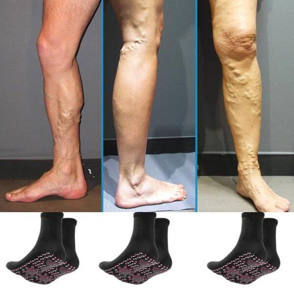 TurmaSocks™ Medias de Turmalina - Adiós Varices en 7 Días (1+1 GRATIS)
