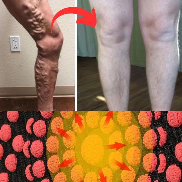 TurmaSocks™ Medias de Turmalina - Adiós Varices en 7 Días (1+1 GRATIS)